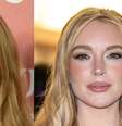 O que Lindsay Lohan fez no rosto? Aparência mais jovem da atriz choca a web e médico explica procedimentos.  Foto: Getty Images / Purepeople