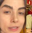 Maria Casadevall, diagnosticada com Síndrome de Eagle, passou por cirurgia e explicou a condição rara: ‘Causa de desconforto’.  Foto: Instagram, Maria Casadevall / Purepeople