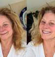 Atriz de 72 anos postou foto sem maquiagem e sem filtros em sua rede social.  Foto: Reprodução/Instagram/@verafischeroficial