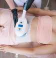O CoolSculpting acontece por meio do congelamento da gordura localizada e o resultado aparece em poucas semanas após as primeiras sessões  Foto: Revista Malu