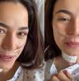 Miss Brasil Julia Gama passa por cirurgia e detalha procedimento delicado  Foto: Reprodução/Instagram / Contigo
