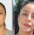 De acordo com a polícia, Danielle Mendes teve um choque anafilático depois de aplicar hialuronidase abaixo dos olhos  Foto: Reprodução/Internet