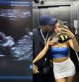 Bia Miranda exibe barriga chapada, mas mostra ultrassom para comprovar 3 meses de gravidez: 'Minha genética é assim'.  Foto: Instagram, Bia Miranda / Purepeople