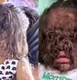 Bebês expostos ao minoxidil podem desenvolver hipertricose, também conhecida como a "síndrome do lobisomem"  Foto: Reprodução / Perfil Brasil