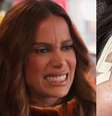 Que procedimento Anitta fez no rosto? Médico analisa caso controverso  Foto: Reprodução/Instagram / Contigo