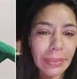 Hulk Magrelo vai ser preso? Humorista foi acusado de violentar a ex-esposa  Foto: Reprodução/Instagram / Contigo