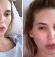 Virginia surge no hospital após ter problemas com chip contraceptivo: 'Sangrando'  Foto: Reprodução/Instagram / Contigo