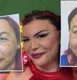 Olha ela! A nova Luisa Marilac após cirurgia plástica que mudou várias parte de seu rosto  Foto: Reprodução/YouTube