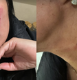 Adriana Müller diz ter sido agredida por mulher em Portugal  Foto: Reprodução/Instagram/@adrianamuller