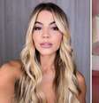 Ex-BBB Hariany surge irreconhecível após três cirurgias: 'Sofri pressão estética'  Foto: Reprodução/Instagram / Contigo