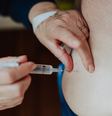 O que é PMMA, substância usada em procedimento estético em mulher que morreu em PE  Foto: Reprodução/Getty Images