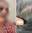 Cuidadora é acusada de agredir idosa com cabo de vassoura durante o banho  Foto: Reprodução/Instagram / Contigo