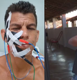 Homem com a 'pior dor do mundo' passa por 20 cirurgias em 10 anos: 'Peço socorro'  Foto: Reprodução/ Instagram e EPTV / Contigo