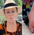 Ana Maria Braga mostrou o pé após ser picada por escorpião  Foto: Reprodução/Instagram 