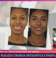 Giovanna conta sobre cirurgia ortognática no 'Mais Você'  Foto: Reprodução/Globo