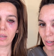 Christy Carlson Romano levou tiros no rosto por engano  Foto: Reprodução