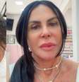 Gretchen exibe fios mais fortes após tratamento de alopecia; veja o antes e depois!  Foto: Reprodução/Instagram / Contigo