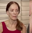 Marília de Godoy mostra dedos machucados após ser assaltada a dentadas  Foto: Reprodução/CNN