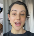 Zé Longuinho mostra resultado após cirurgia de feminização facial  Foto: Reprodução/Instagram
