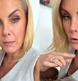 Ana Hickmann deu detalhes do estado de saúde de um de seus cachorros  Foto: Reprodução/Instagram / Contigo