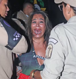 Mulher presa por morder pessoas em camarote na Sapucaí responde por 3 crimes  Foto: Rogério Fidalgo/ AGNEWS / Contigo