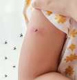 Dengue pode ser grave em crianças e adolescentes  Foto: Shutterstock / Alto Astral
