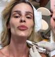 Botox Nefertiti: conheça o procedimento realizado por Yasmin Brunet  Foto: Reprodução / Viva Saúde