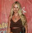 'Fantástico' aborda o Lipedema: em matéria na TV Globo, Yasmin Brunet mostra mostra antes e depois e faz revelação: 'Já estava ali...'.  Foto: AGNews / Purepeople