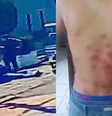 Motociclista leva tiro de bala de borracha e é espancado em abordagem de guardas municipais no RS  Foto: Reprodução/Redes Sociais