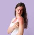 Cuidados simples ajudam a recuperar a pele após a queimadura de sol  Foto: Pixel-Shot | Shutterstock / Portal EdiCase