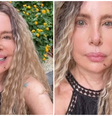 Isis de Oliveira celebra cura do câncer de pele: 'Estou livre'  Foto: Reprodução/Instagram/@isisdeoliveirareal