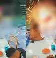 Criança sofre descarga elétrica ao encostar em fiação durante brincadeira no Pará.  Foto: Reprodução/Redes sociais 