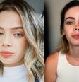 Ana Luiza Prestes, cirurgiã-dentista de 29 anos, passou por cirurgia para a retirada do tumor  Foto: Reprodução/Instagram