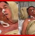 Bolsonaro publica vídeo durante internação em Natal e fala em ‘possível intervenção cirúrgica'  Foto: 