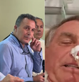 Médicos dizem que Bolsonaro deve ter mais episódios de dores abdominais  Foto: Reprodução/Instagram @hospitalriogrande e @jairmessiasbolsonaro