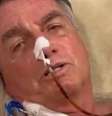Bolsonaro passa por cirurgia delicada e tem boletim médico atualizado  Foto: Reprodução/Instagram / Contigo