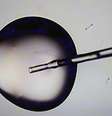 Processo de inseminação in vitro  Foto: David L. Ryan/The Boston Globe / Getty Images