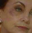 Odete Roitman (Beatriz Segall) ferida por um amante na versão original de 'Vale Tudo'  Foto: Reprodução