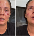 Mulher é arremessada de montanha-russa em parque aquático recém-inaugurado: 'Foi desesperador'  Foto: Reprodução/Instagram/@rotina_foradoar