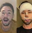 Antes e depois de Rico Melquiades: 40 fotos mostram mudança radical do influenciador com procedimentos estéticos.  Foto: Reprodução, Facebook/Divulgação Geraldo Magela/Agência Senado / Purepeople