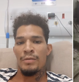 Ambulante de Fernando de Noronha que foi baleado por delegado tem perna amputada  Foto: Reprodução/Instagram