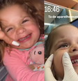 Maria Flor mostra como ficou aparelho de contenção dentária  Foto: Instagram/@virginia / Reprodução