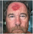 Fotógrafo registra momento em que é atingido por tiro de policial durante protestos nos EUA  Foto: Reprodução/X/@nypost