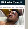 O passageiro Vishwash Kumar Ramesh, de 40 anos, disse ter sobrevivido ao acidente aéreo com o avião da Air India  Foto: Reprodução/Hindustan Times