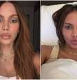 Anitta aparece com rosto diferente e gera curiosidade sobre procedimentos realizados  Foto: Reprodução/Instagram