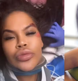 Ex-Big Brother se acidenta e reclama da falta de socorro  Foto: reprodução/instagram / Contigo
