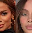 Lifting endoscópio e lifting labial: cirurgião plástico lista 4 indícios de que Anitta passou pelos 2 procedimentos estéticos.  Foto: Divulgação, TV Globo/Reprodução Instagram / Purepeople