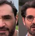 Antes e depois: Marcelo Cosme parece alguns anos mais jovem após o implante  Foto: Reproduções