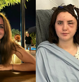 Moli Morgan descobriu um tumor no cérebro aos 22 anos  Foto: Reprodução/The Sun