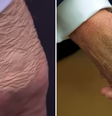 Antes de diagnóstico, Trump foi flagrado com mão maquiada e pés inchados  Foto: Reprodução/Youtube